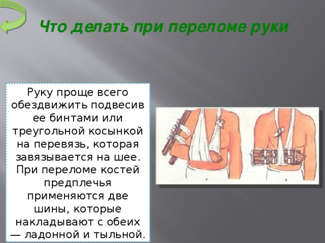 Переломы и вывихи костей предплечья и кисти презентация